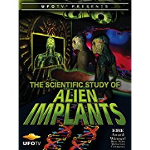 THE SCIENTIFIC STUDY OF ALIEN IMPLANTS のサムネイル画像