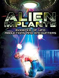 ALIEN IMPLANTS: EVIDENCE OF UFO ABDUCTIONS AND ENCOUNTERS のサムネイル画像